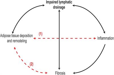 The Unresolved Pathophysiology of Lymphedema